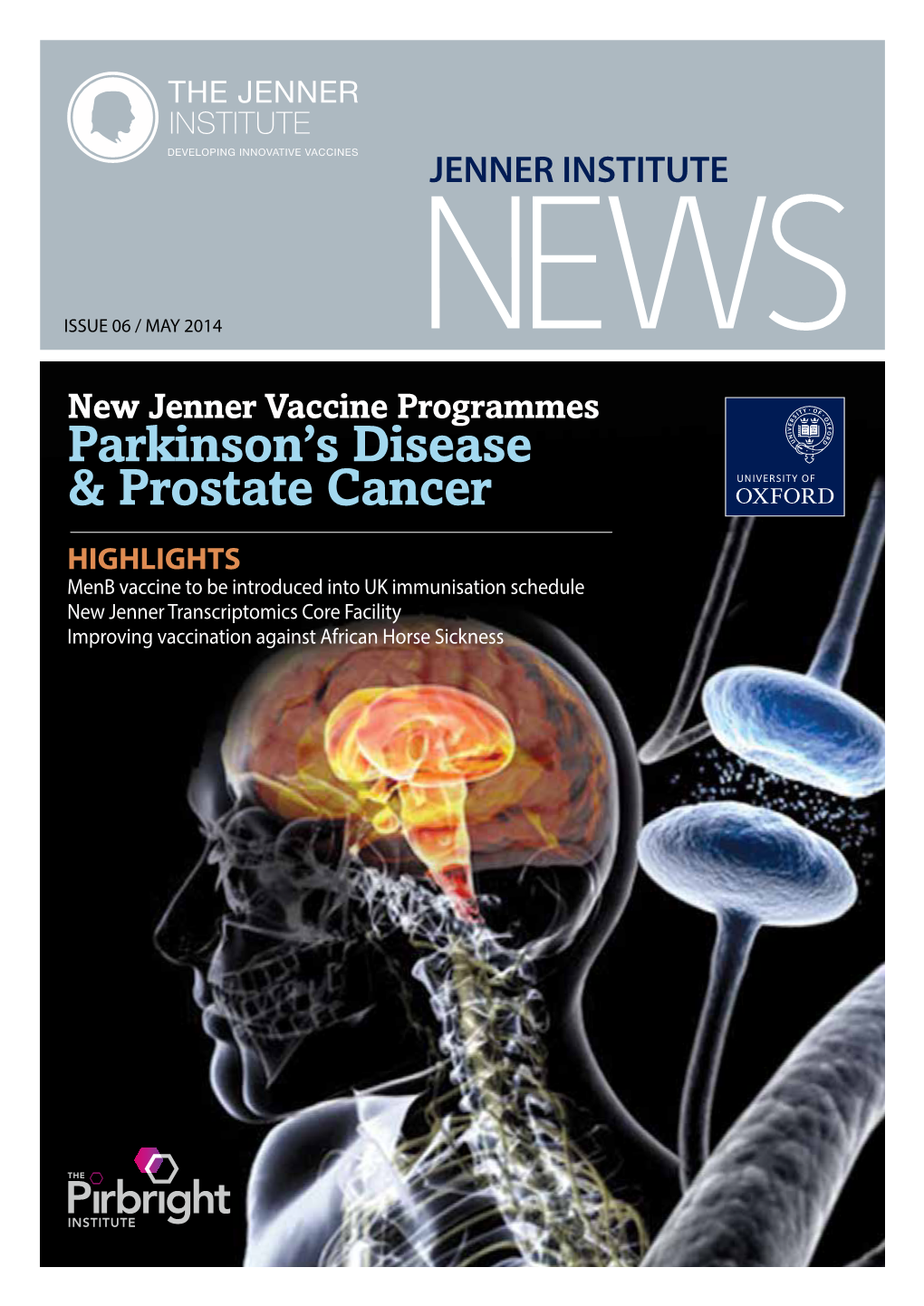 Parkinson's Disease & Prostate Cancer