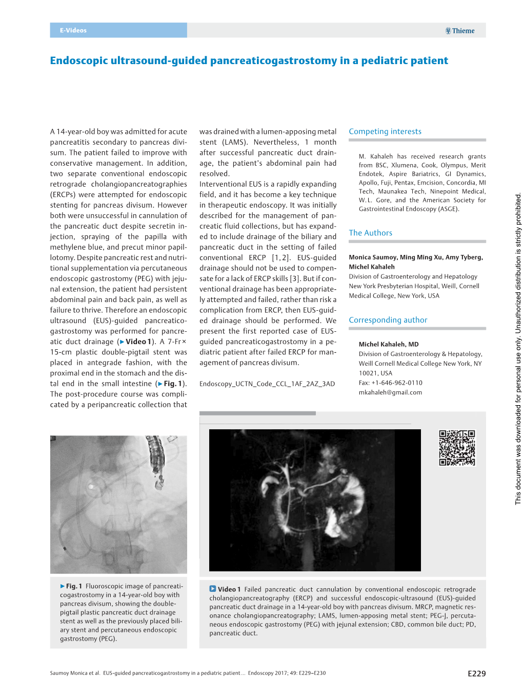 Endoscopic Ultrasound-Guided Pancreaticogastrostomy in a Pediatric Patient