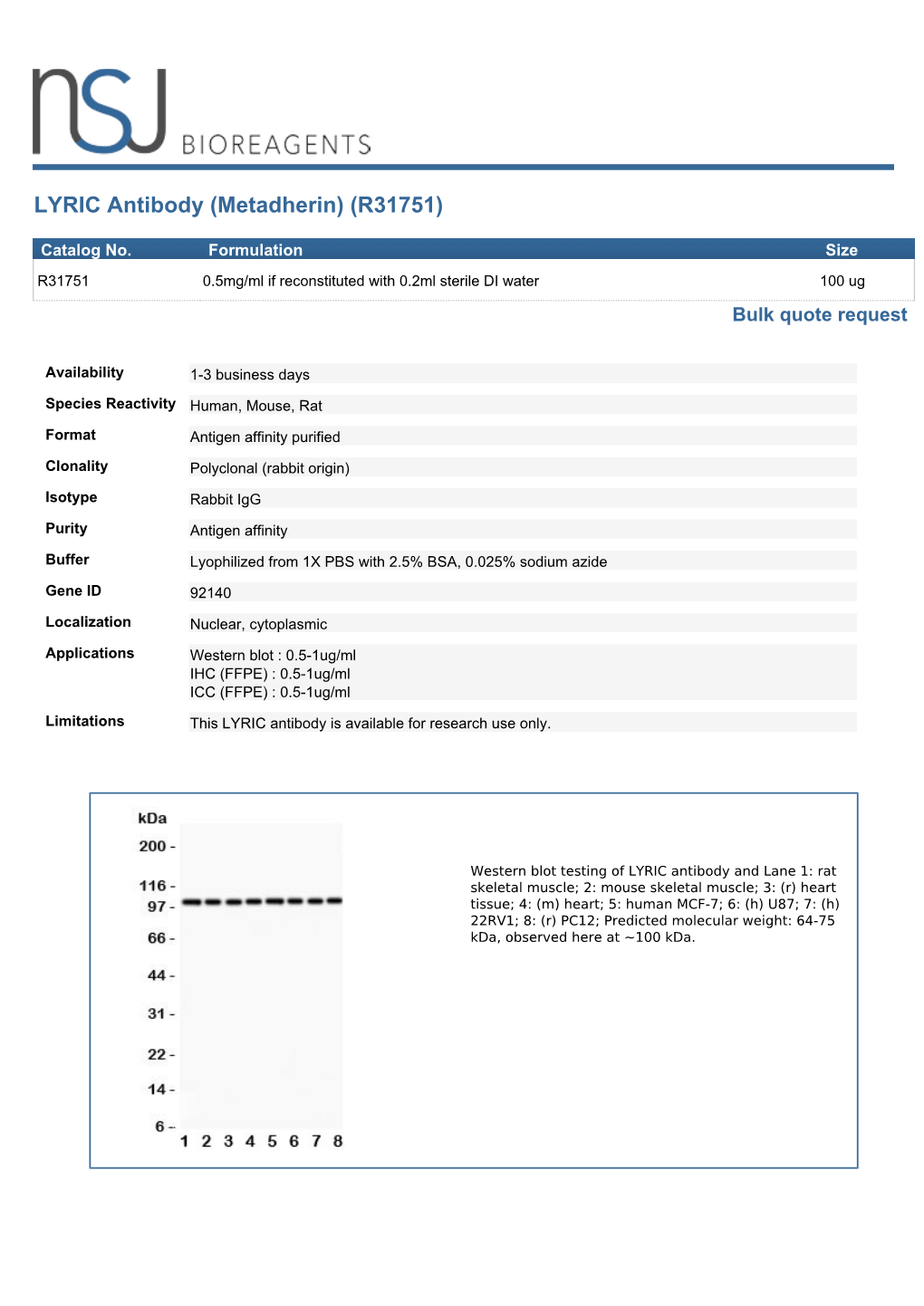 LYRIC Antibody (Metadherin) (R31751)