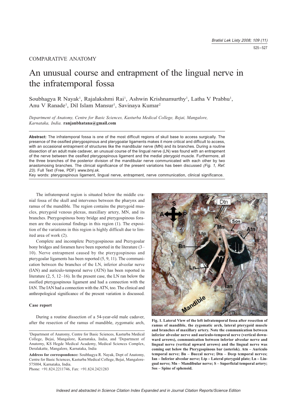 An Unusual Course and Entrapment of the Lingual Nerve in the Infratemporal Fossa