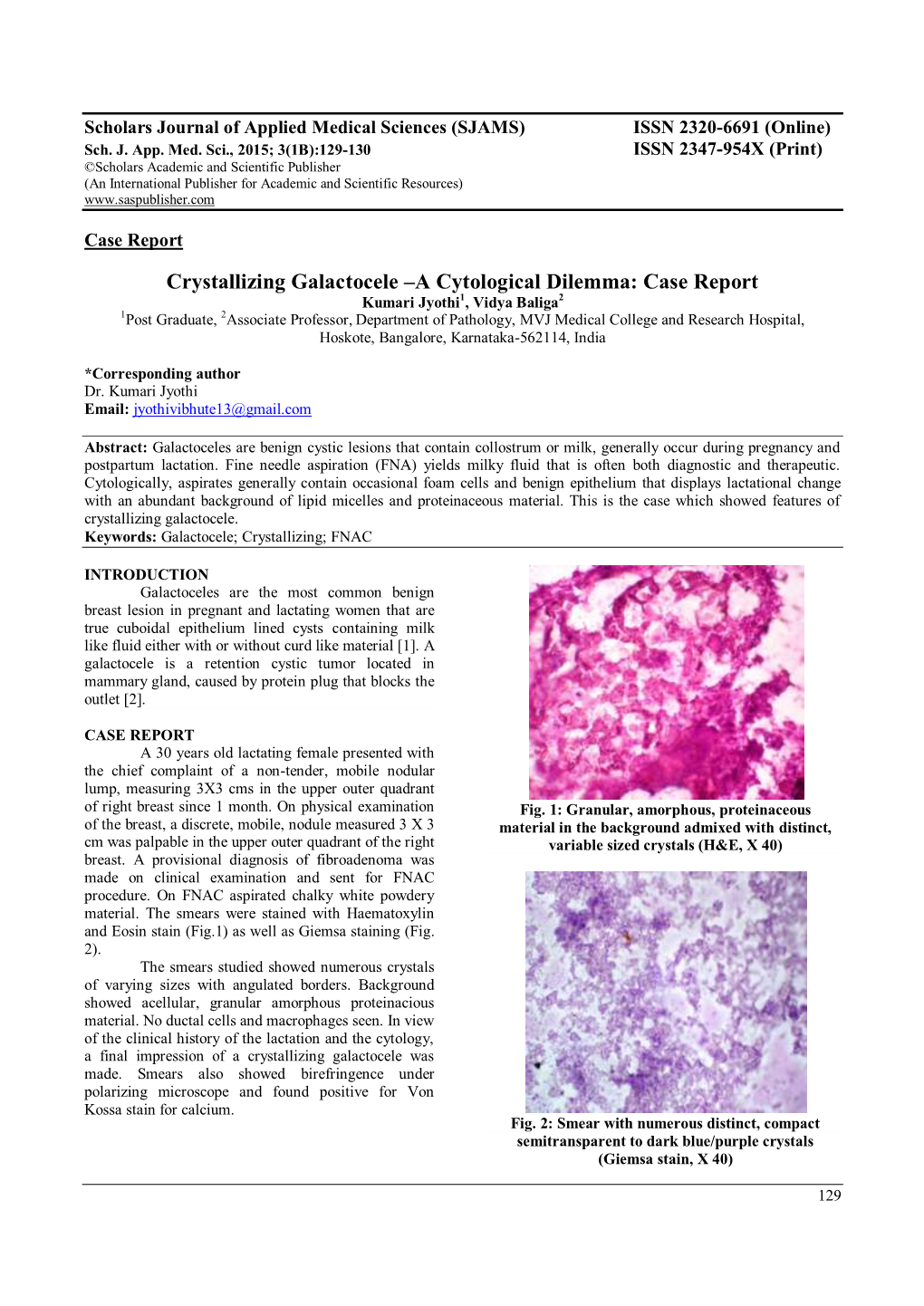 Crystallizing Galactocele