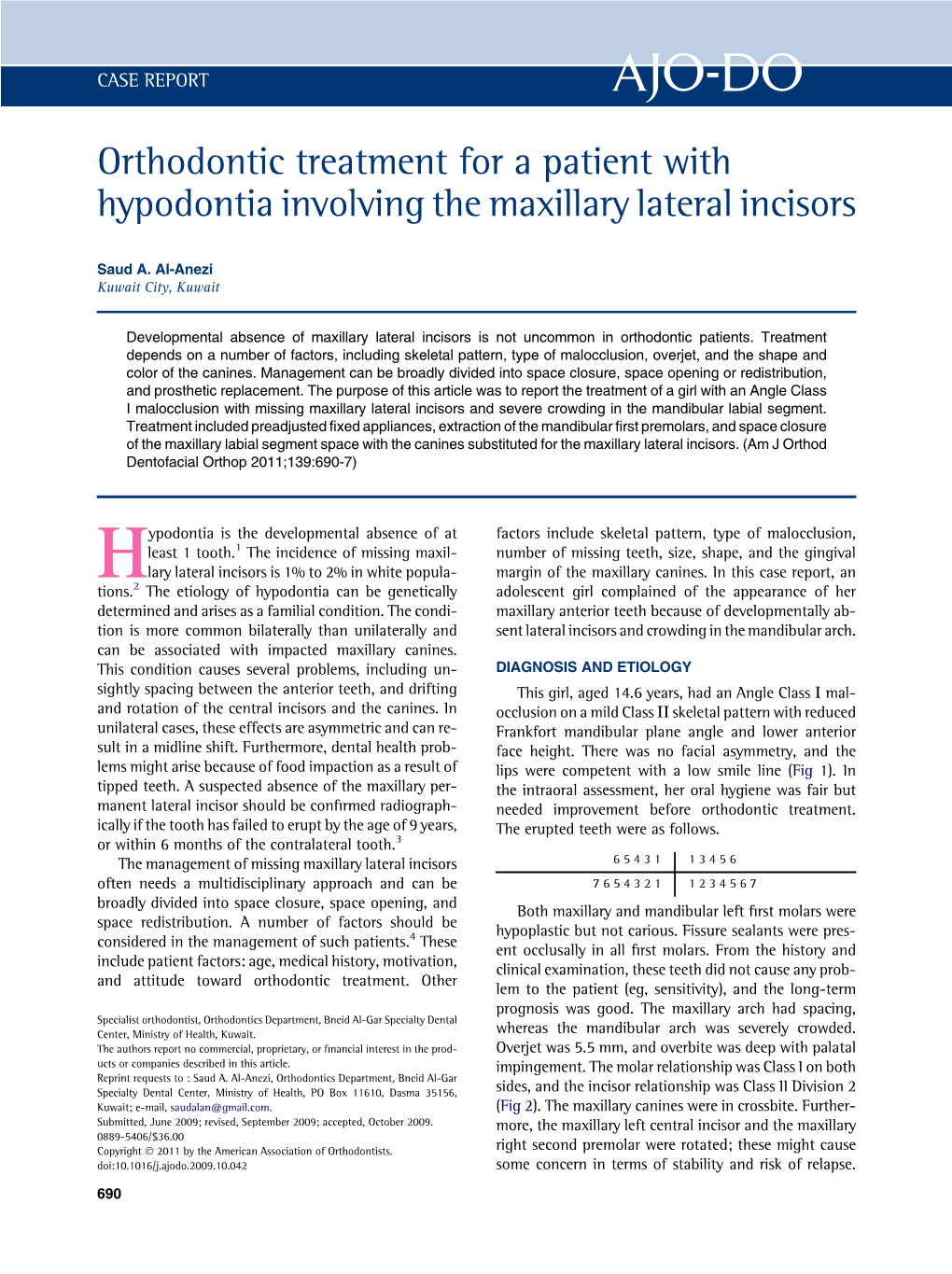 Orthodontic Treatment for a Patient with Hypodontia Involving the Maxillary Lateral Incisors