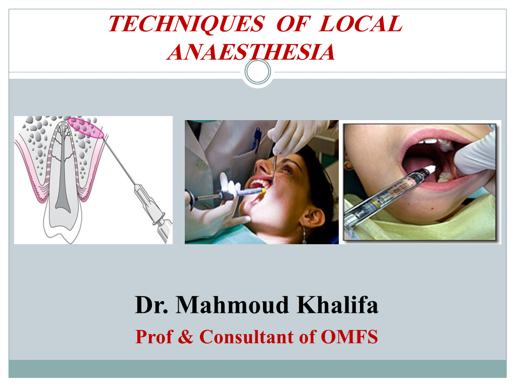 Nerve Block Techniques of Local Anesthesia ♦ Local Infiltration: Small Terminal Nerve Endings Are Flooded with Local Anesthetic Solution