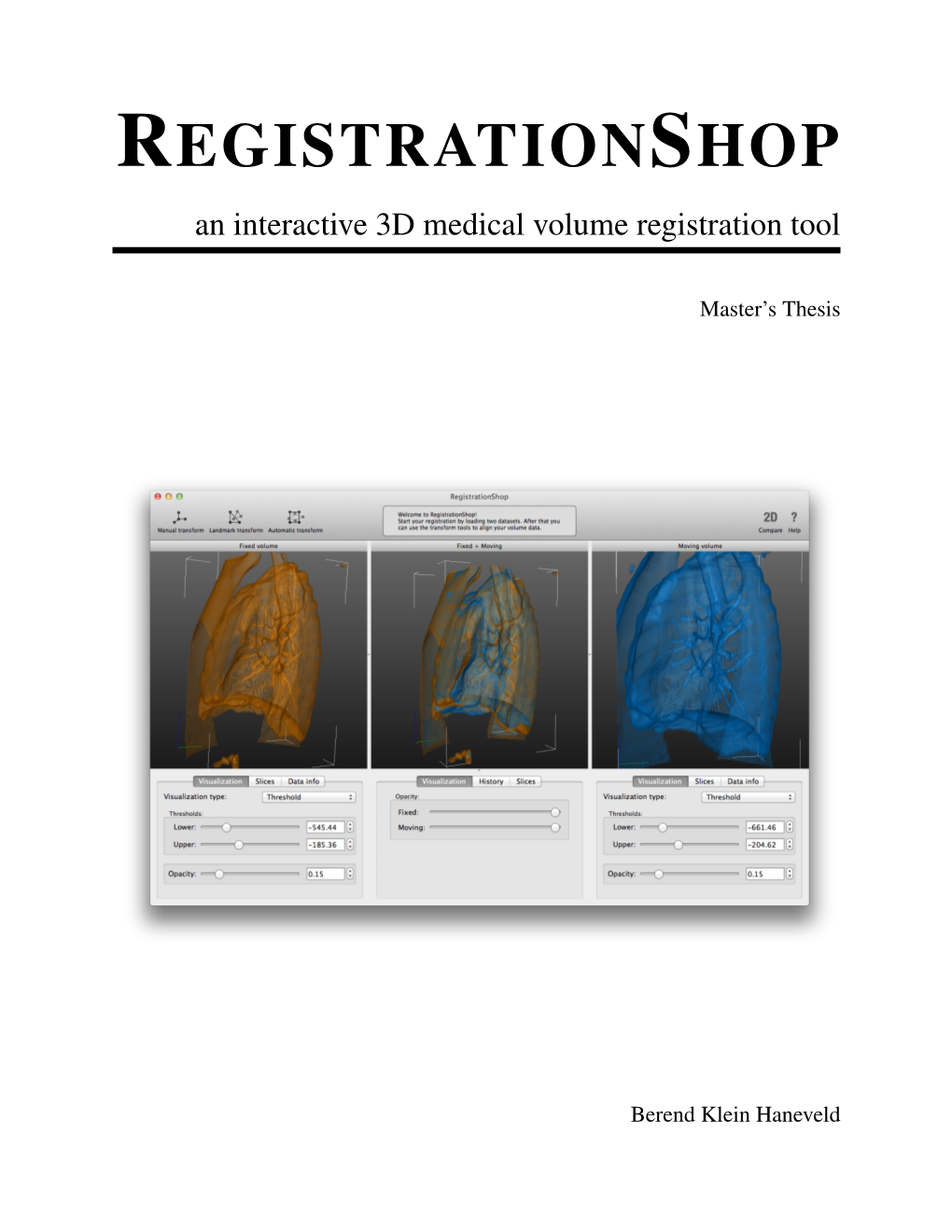 REGISTRATIONSHOP an Interactive 3D Medical Volume Registration Tool