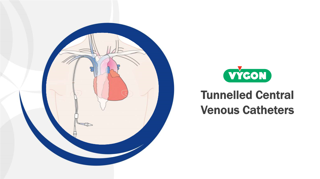 Tunnelled Central Venous Catheters TCVC What Is It?