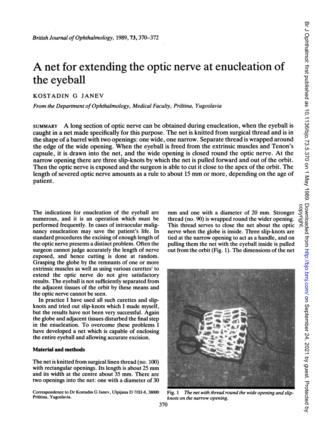 A Net for Extending the Optic Nerve at Enucleation of the Eyeball KOSTADIN G JANEV from the Department Ofophthalmology, Medical Faculty, Prigtina, Yugoslavia