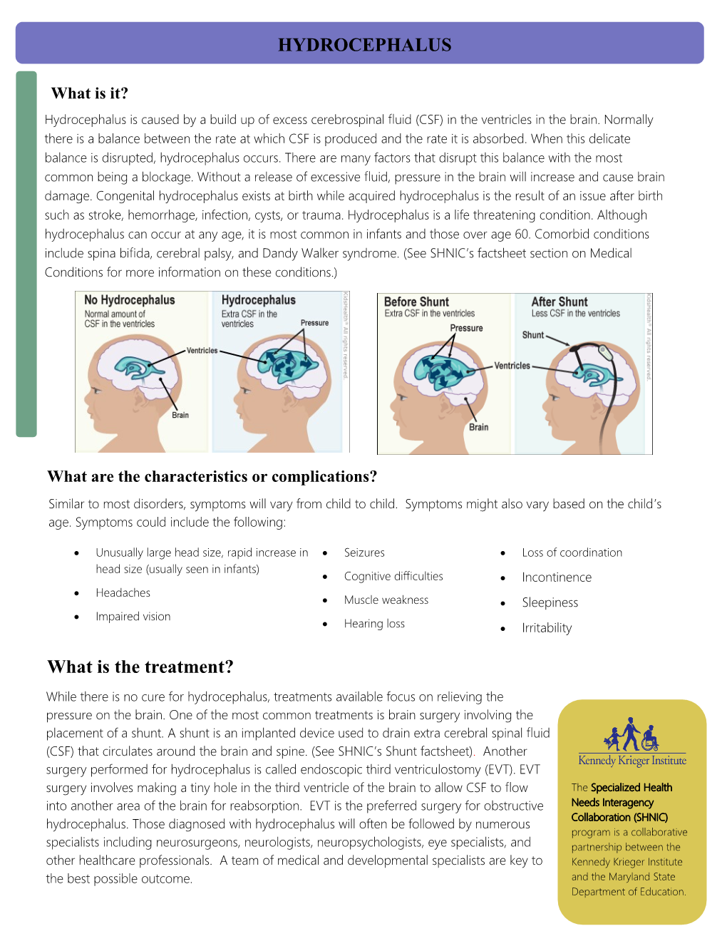 Hydrocephalus