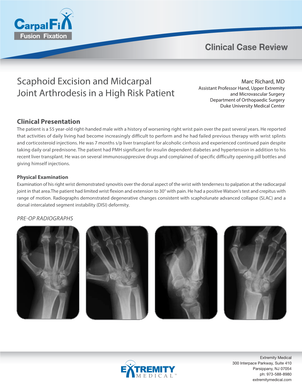 Scaphoid Excision and Midcarpal Joint Arthrodesis in a High Risk Patient