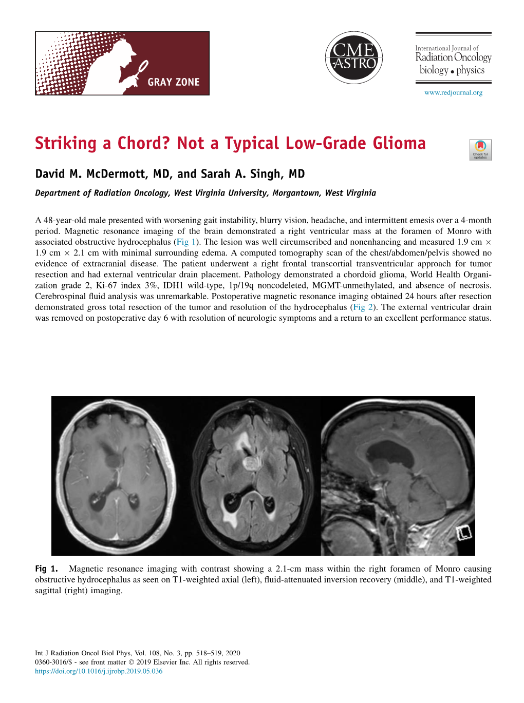 Striking a Chord? Not a Typical Low-Grade Glioma