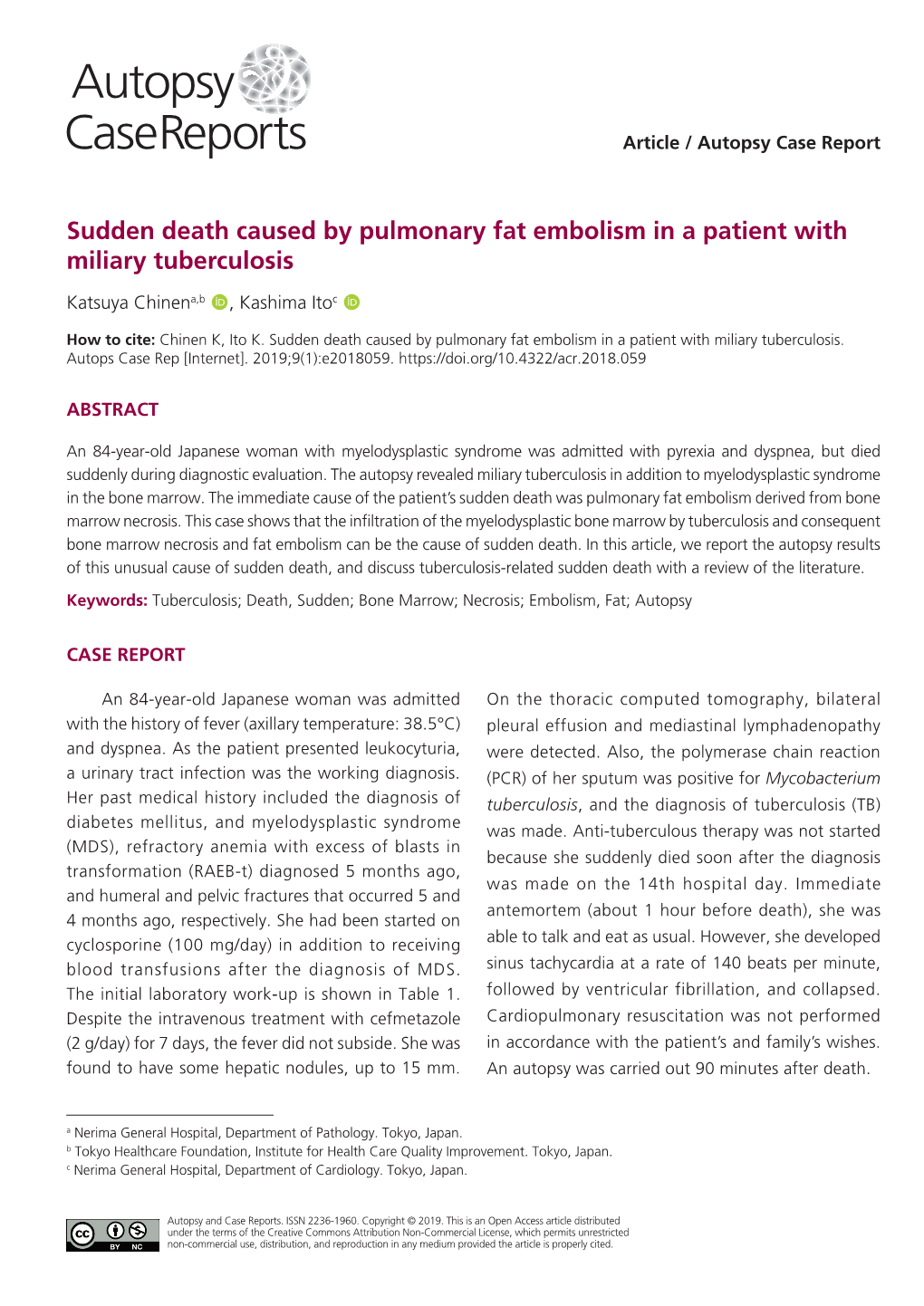 Sudden Death Caused by Pulmonary Fat Embolism in a Patient with Miliary Tuberculosis