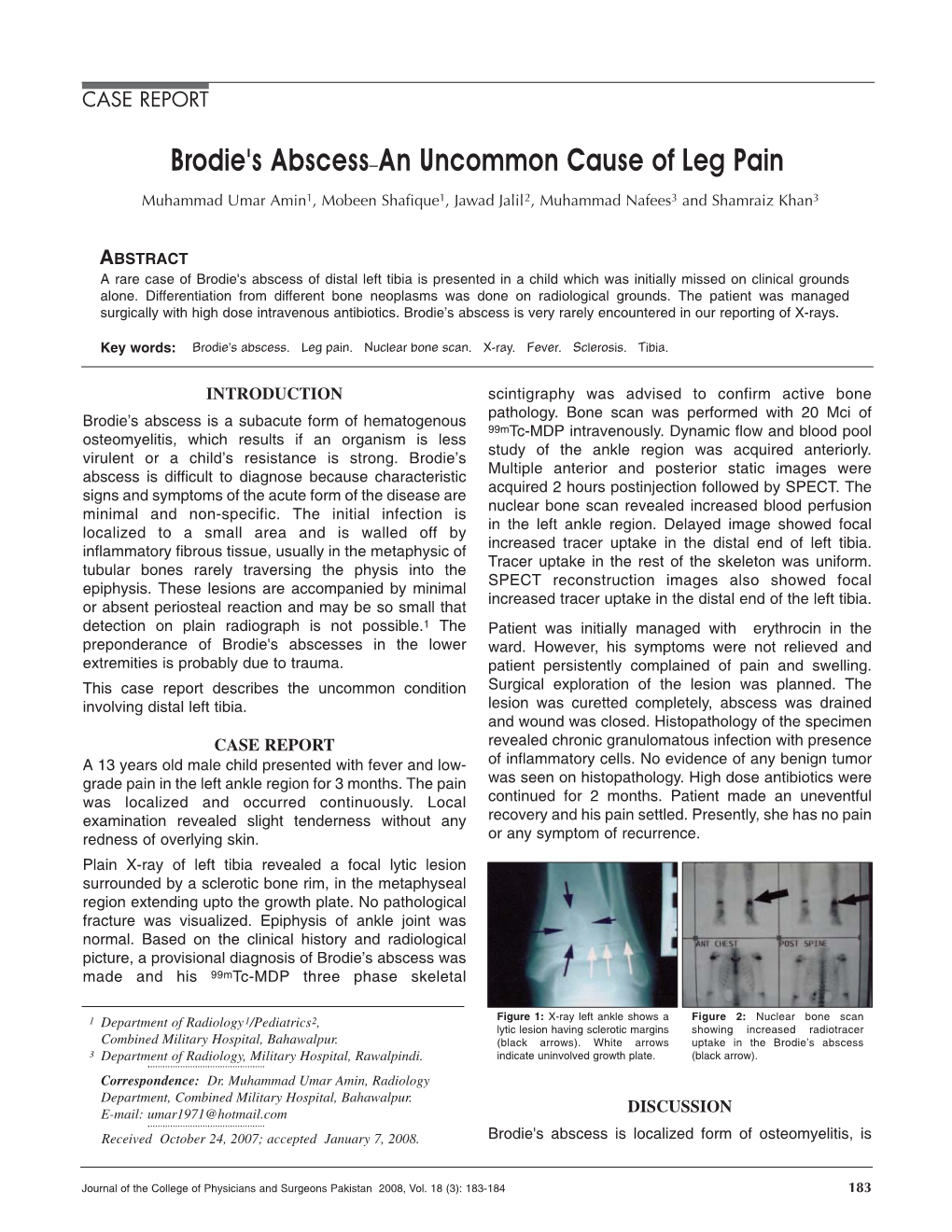 Brodie's Abscess–An Uncommon Cause of Leg Pain