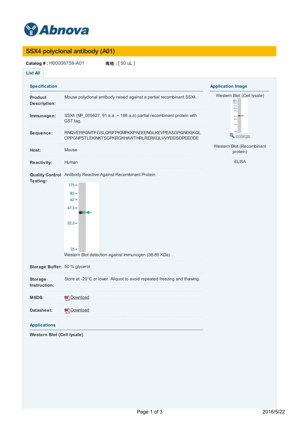 SSX4 Polyclonal Antibody (A01)