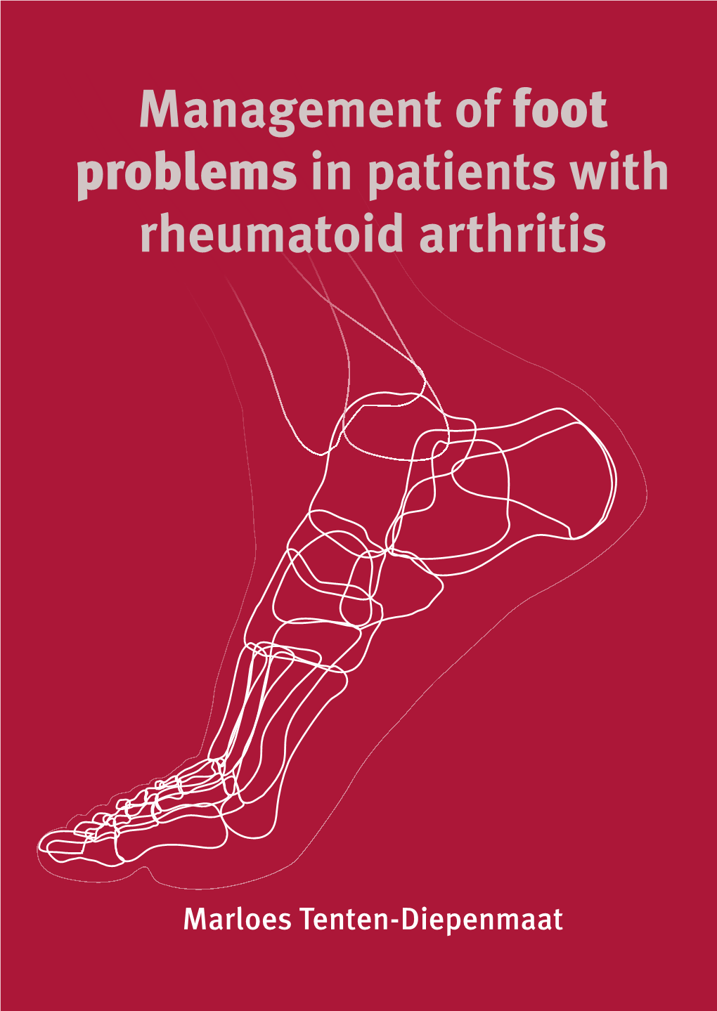 Management of Foot Problems in Patients with Rheumatoid Arthritis