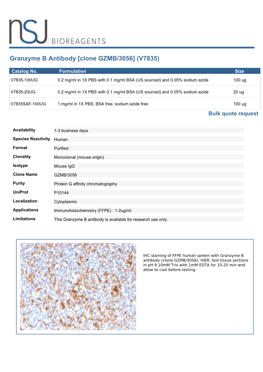 Granzyme B Antibody [Clone GZMB/3056] (V7835)
