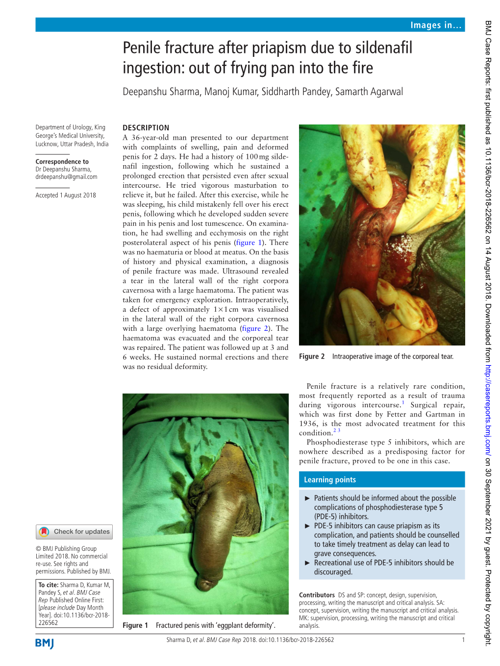 Penile Fracture After Priapism Due to Sildenafil Ingestion: out of Frying Pan Into the Fire Deepanshu Sharma, Manoj Kumar, Siddharth Pandey, Samarth Agarwal