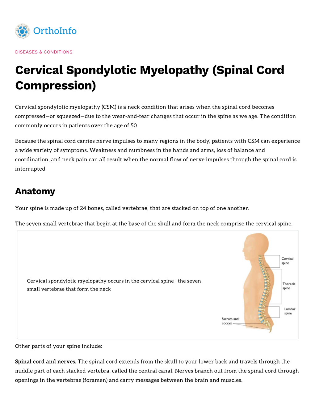 Cervical Spondylotic Myelopathy (Spinal Cord Compression)