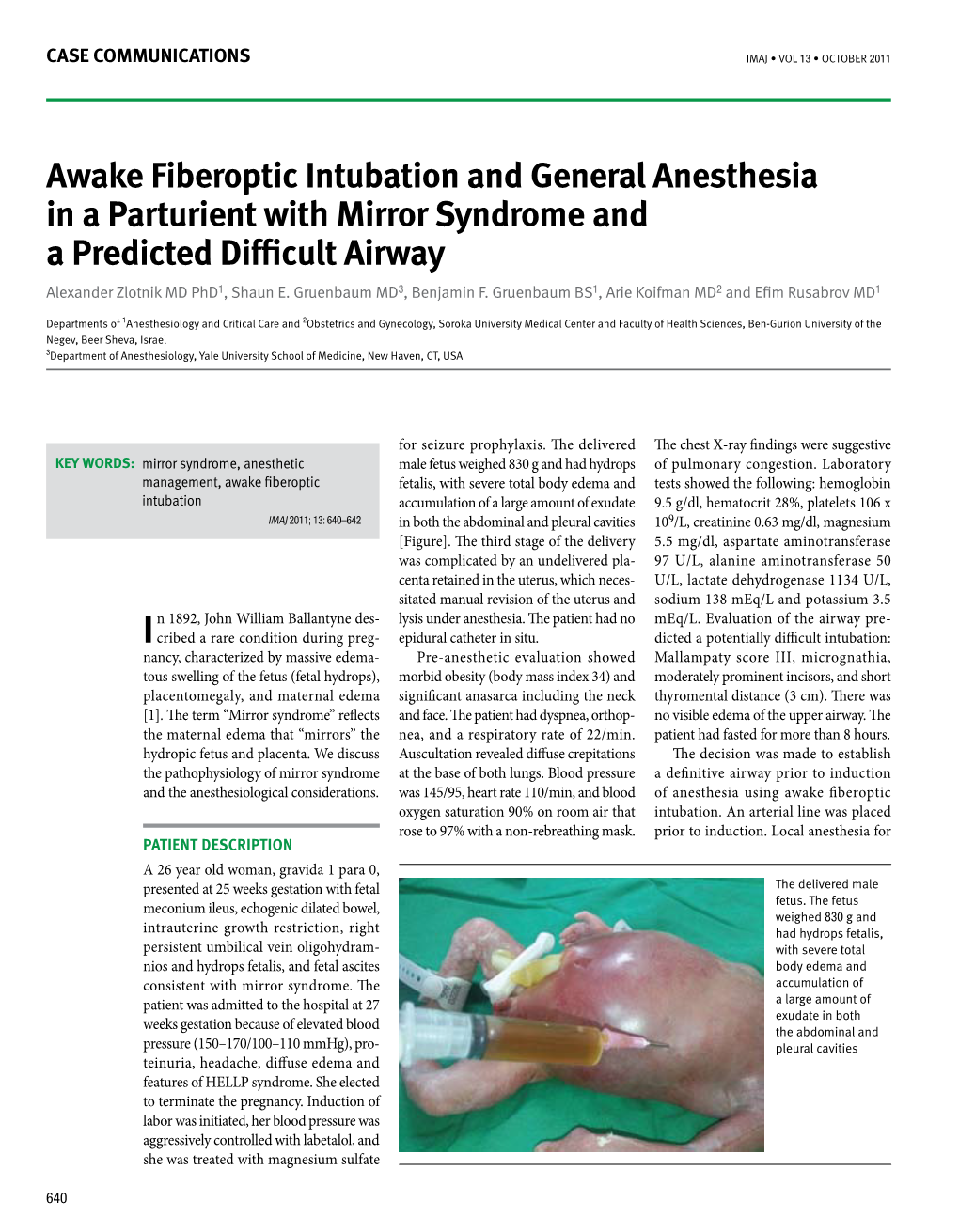Awake Fiberoptic Intubation and General Anesthesia in a Parturient with Mirror Syndrome and a Predicted Difficult Airway Alexander Zlotnik MD Phd1, Shaun E