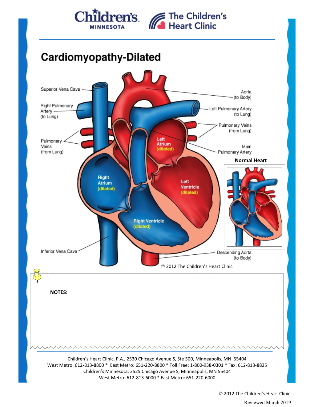 Dilated Cardiomyopathy