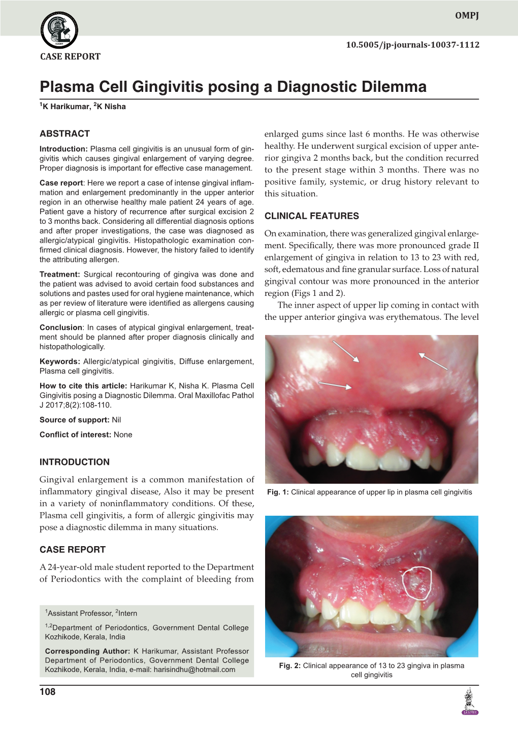 Plasma Cell Gingivitis Posing a Diagnostic Dilemma 1K Harikumar, 2K Nisha