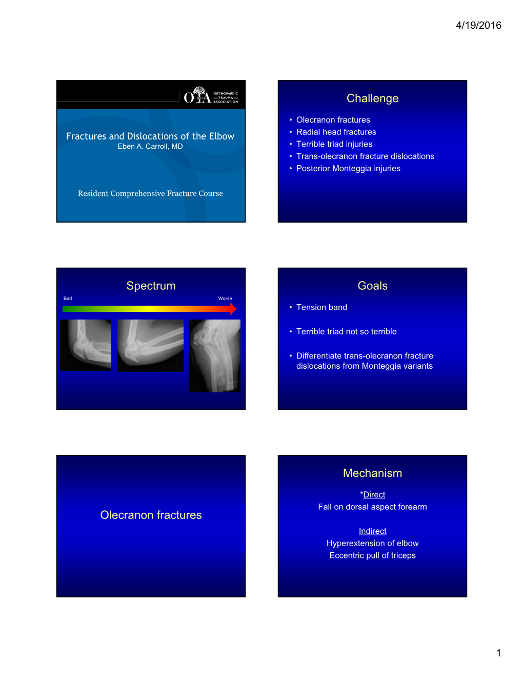 Challenge Spectrum Goals Olecranon Fractures Mechanism