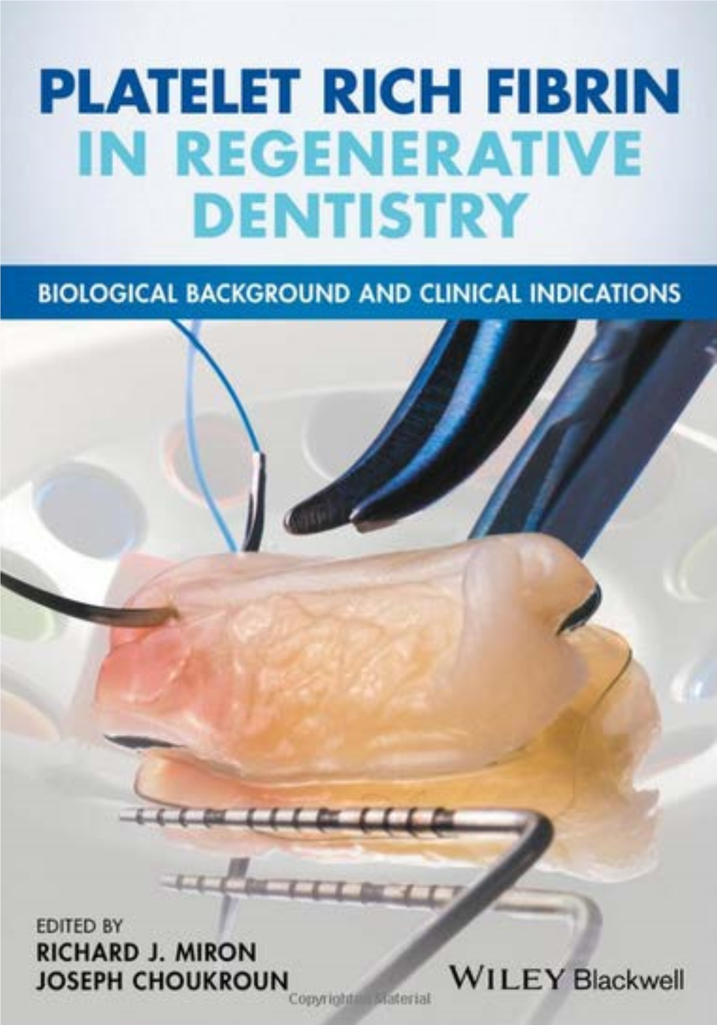 Platelet Rich Fibrin in Regenerative Dentistry Platelet Rich Fibrin in Regenerative Dentistry