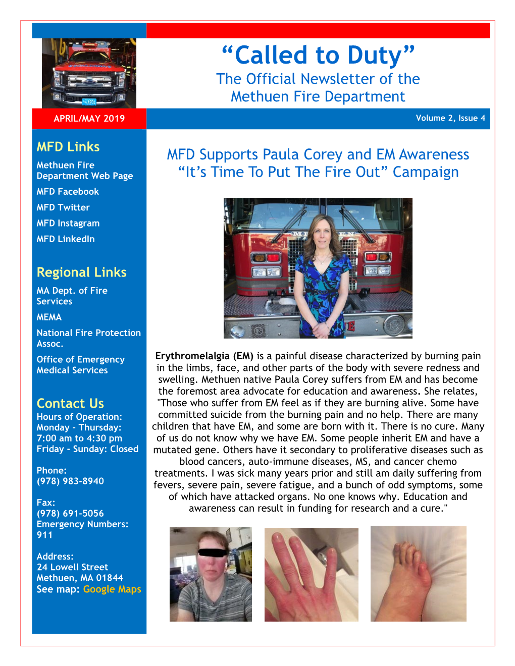“Called to Duty” the Official Newsletter of the Methuen Fire Department APRIL/MAY 2019 Volume 2, Issue 4