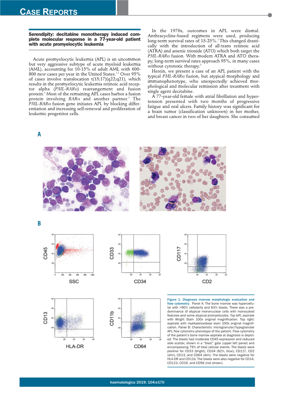 Decitabine Monotherapy Induced Complete Molecular Response in A