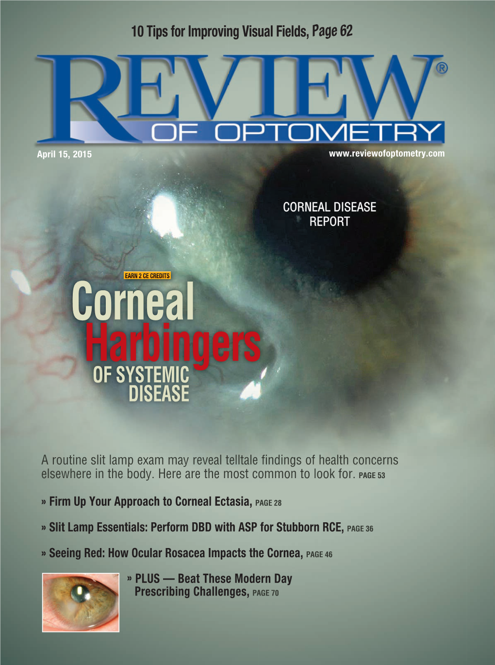 Corneal Harbingers of SYSTEMIC DISEASE