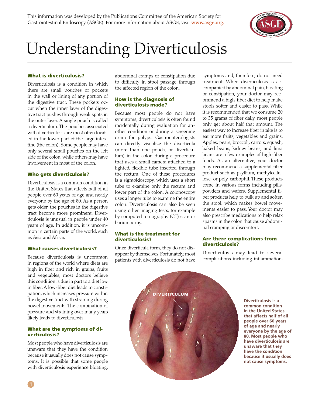 Understanding Diverticulosis