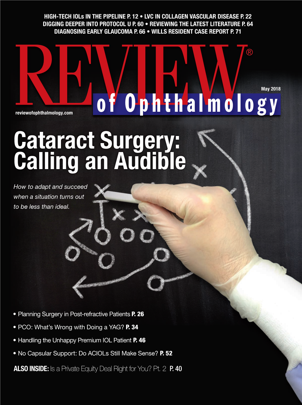Cataract Surgery: Calling an Audible