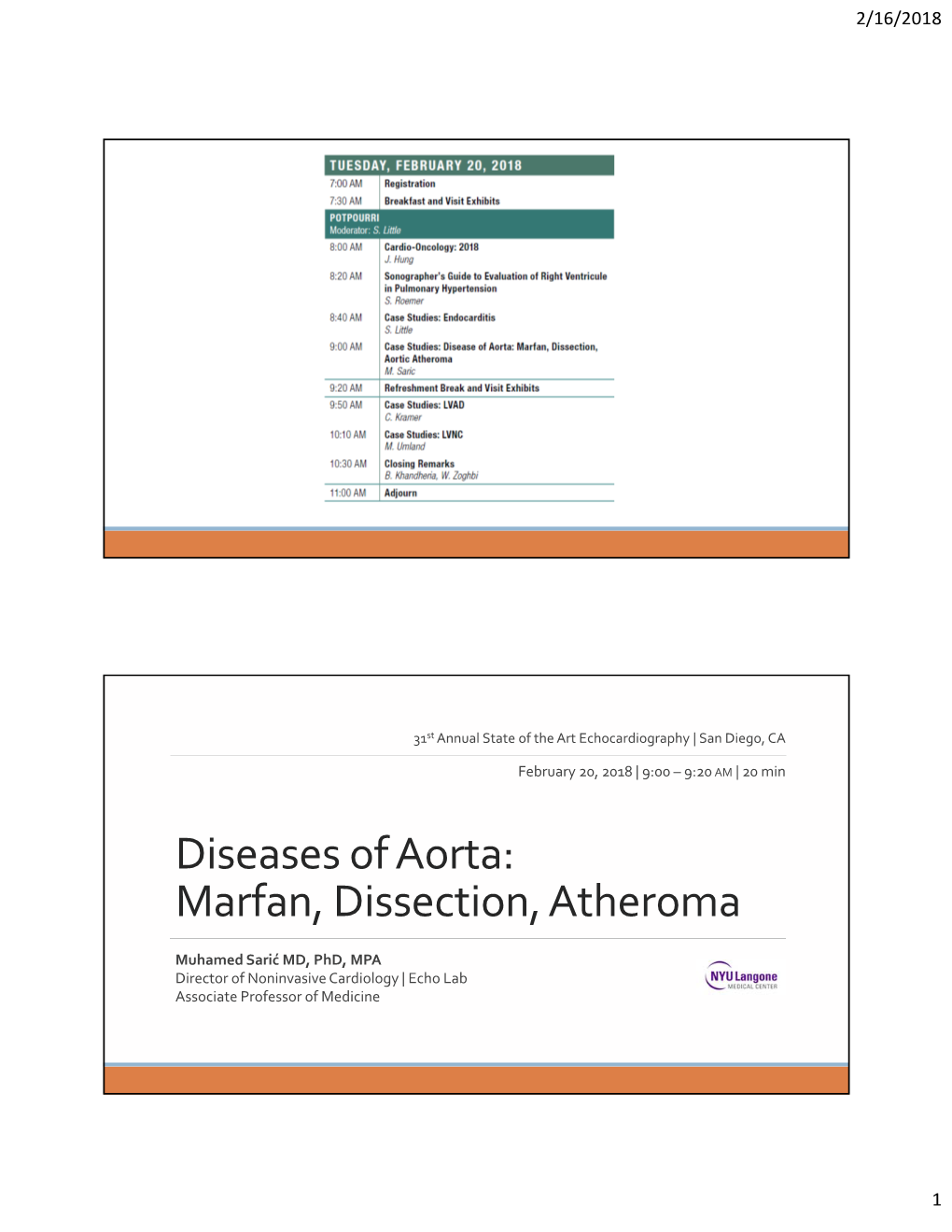 Diseases of Aorta: Marfan, Dissection, Atheroma