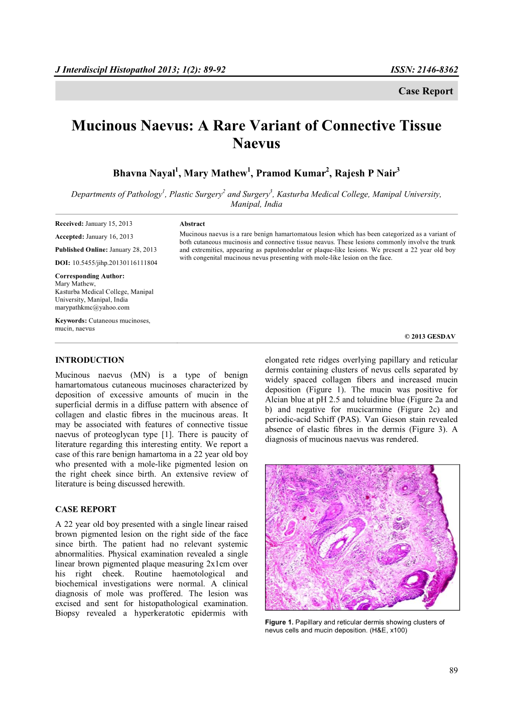 A Rare Variant of Connective Tissue Naevus