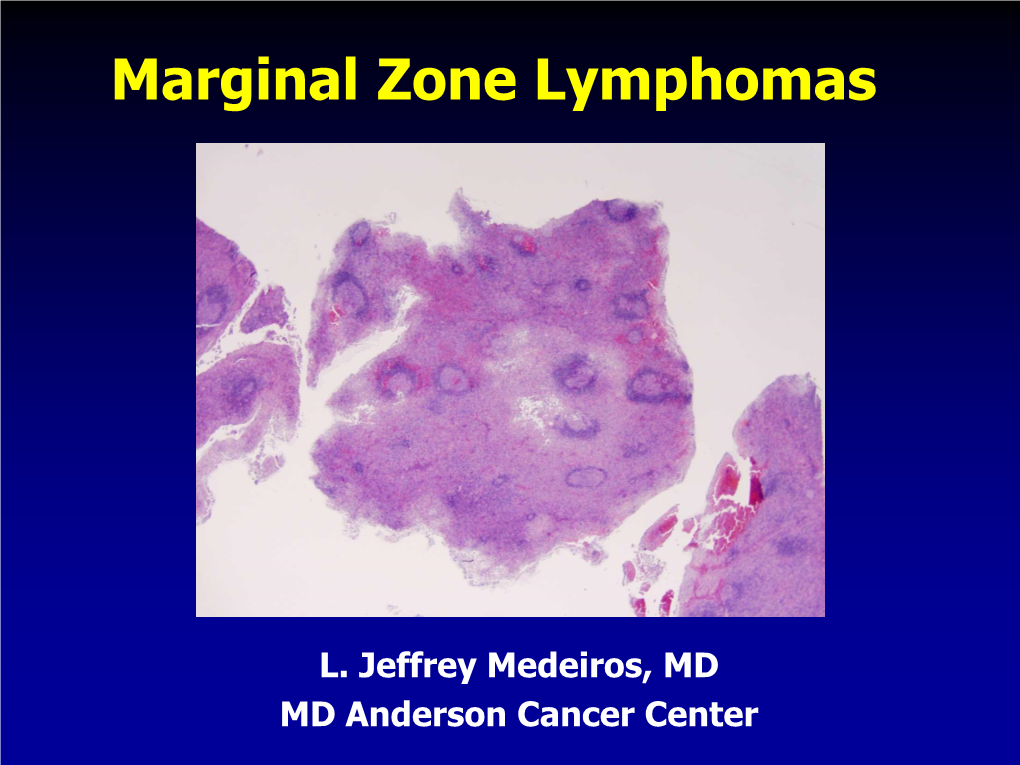 Marginal Zone Lymphomas