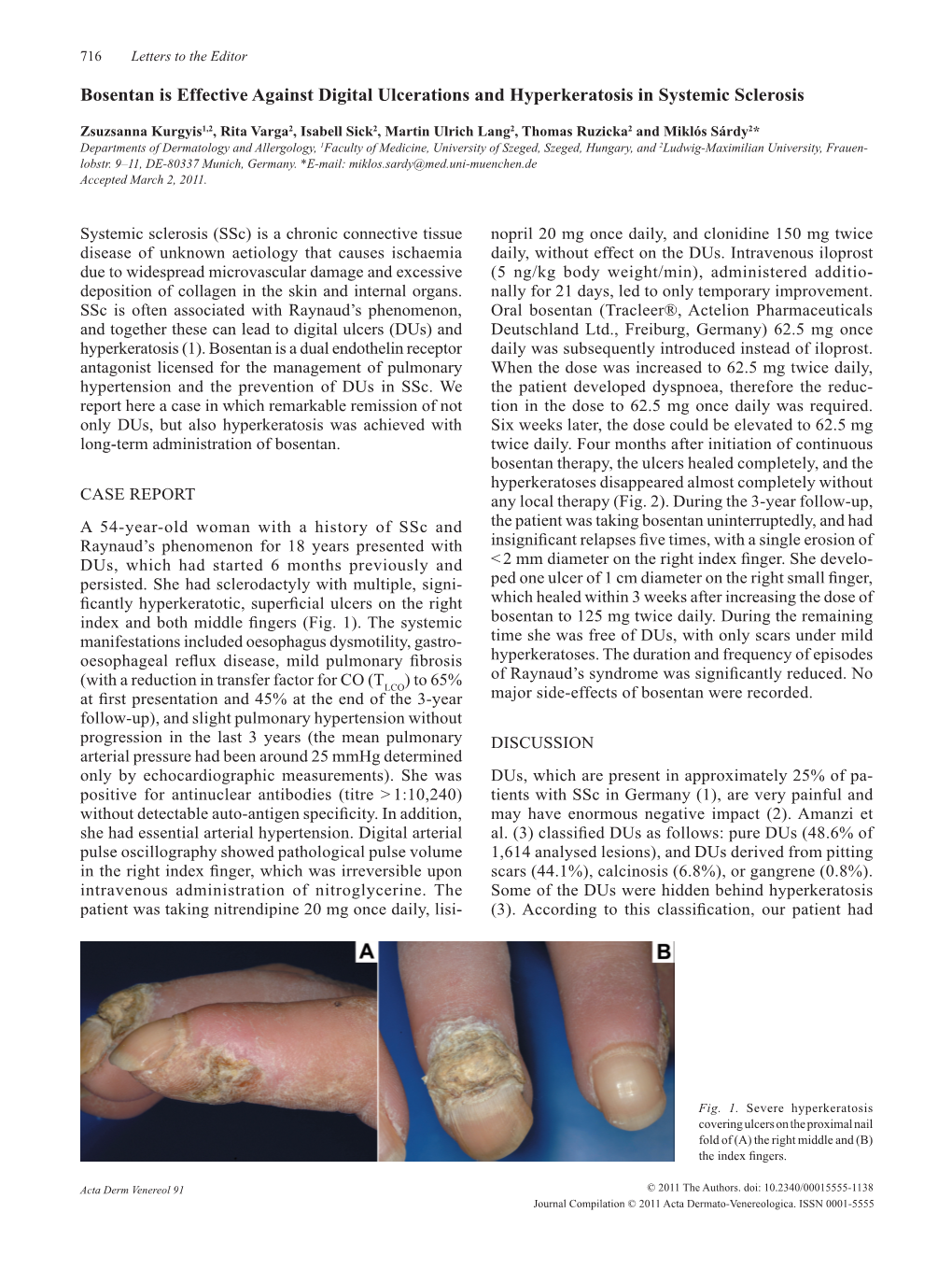Bosentan Is Effective Against Digital Ulcerations and Hyperkeratosis in Systemic Sclerosis