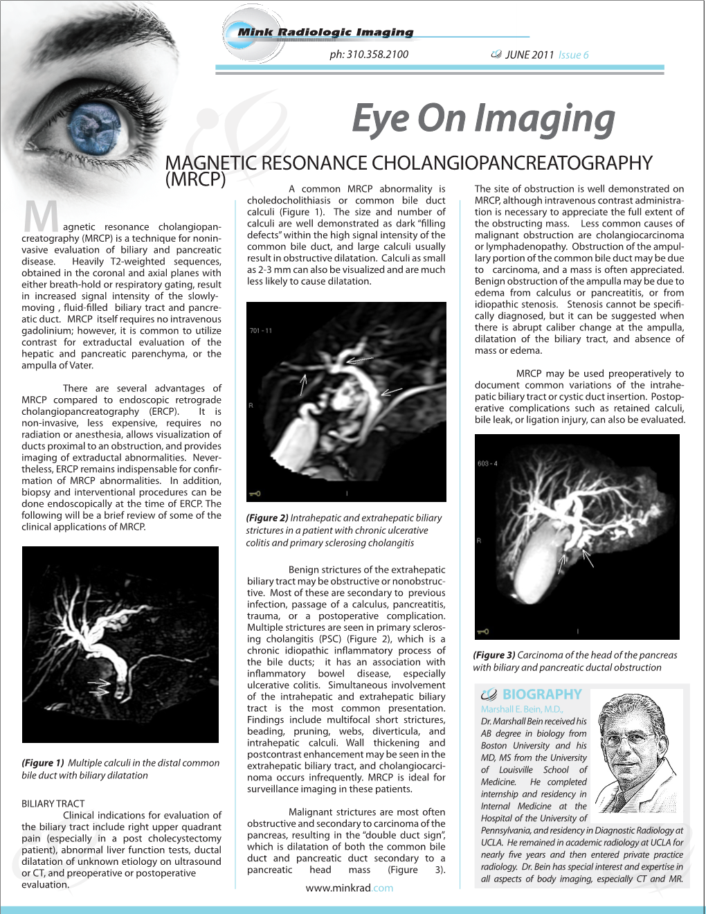 Eye on Imaging