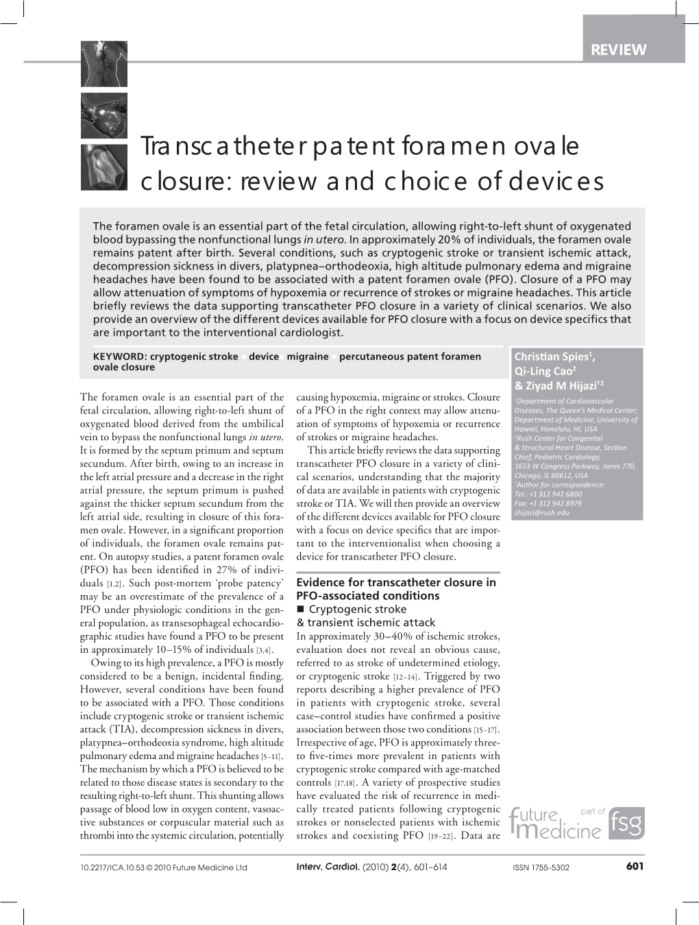 Transcatheter Patent Foramen Ovale Closure: Review and Choice of Devices