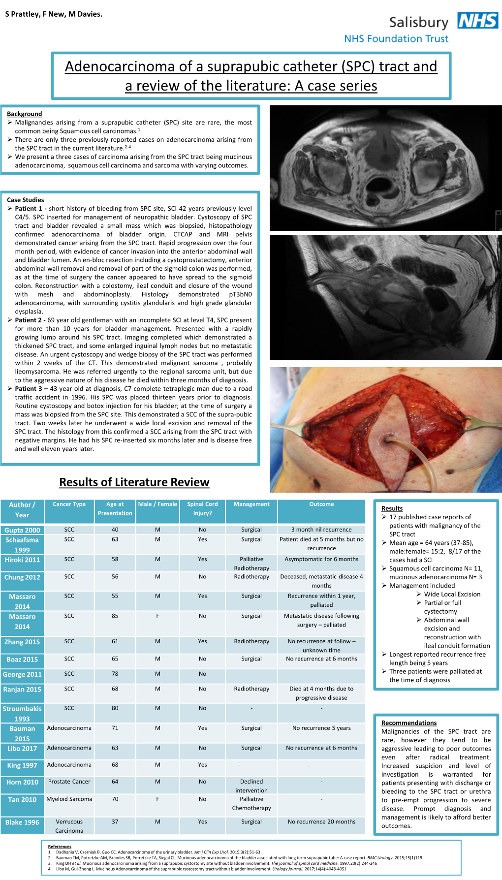 Adenocarcinoma of a Suprapubic Catheter (SPC) Tract and a Review of the Literature: a Case Series