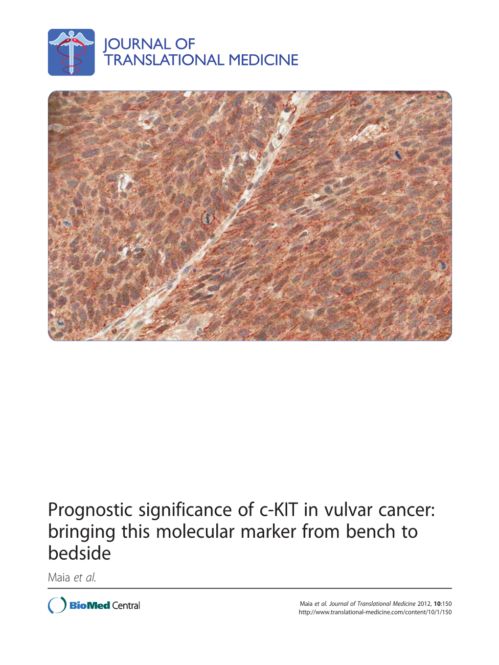 Prognostic Significance of C-KIT in Vulvar Cancer: Bringing This Molecular Marker from Bench to Bedside Maia Et Al