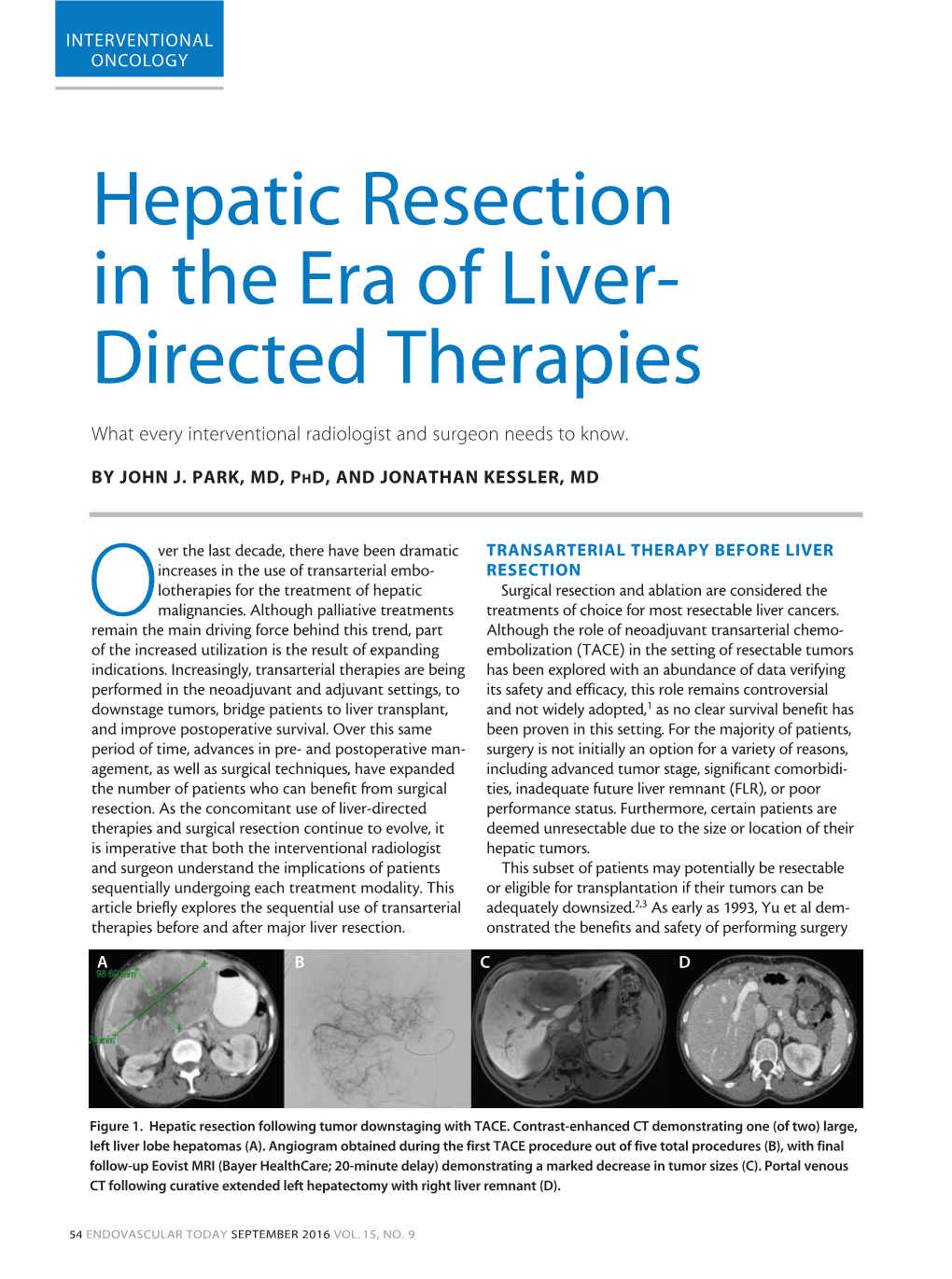 Hepatic Resection in the Era of Liver- Directed Therapies