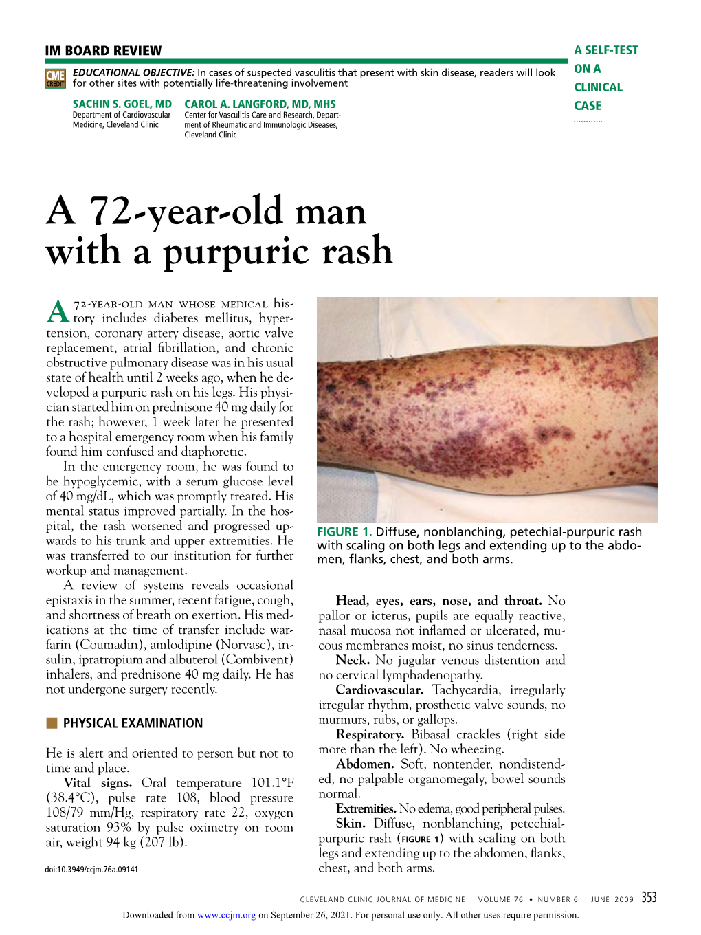 A 72-Year-Old Man with a Purpuric Rash