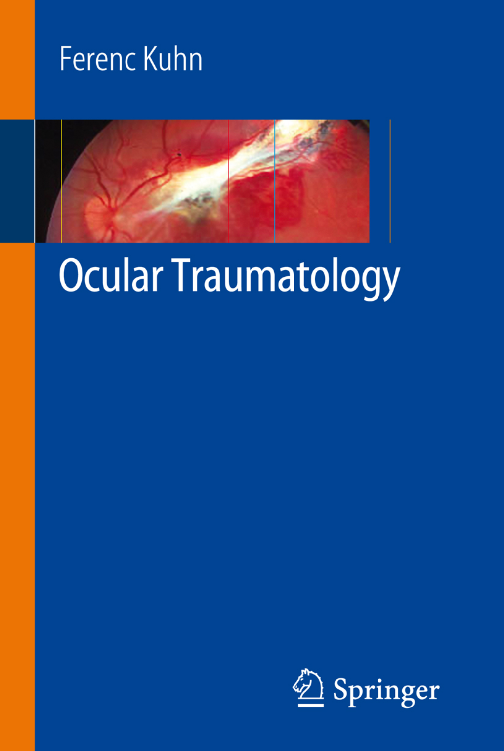 Ocular Traumatology Ferenc Kuhn