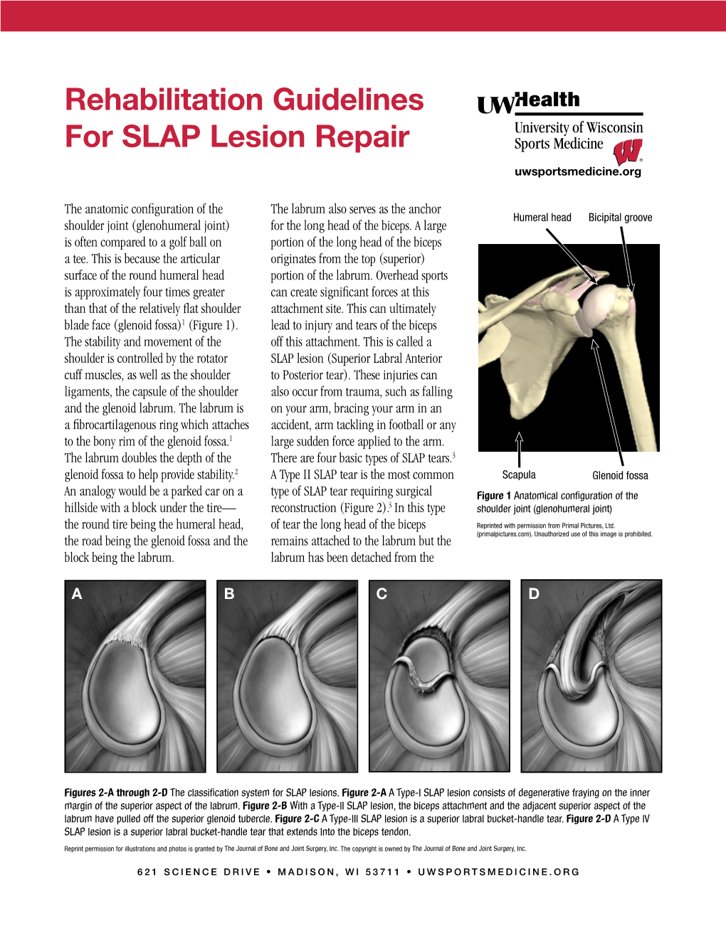 (SLAP) Lesion Repair