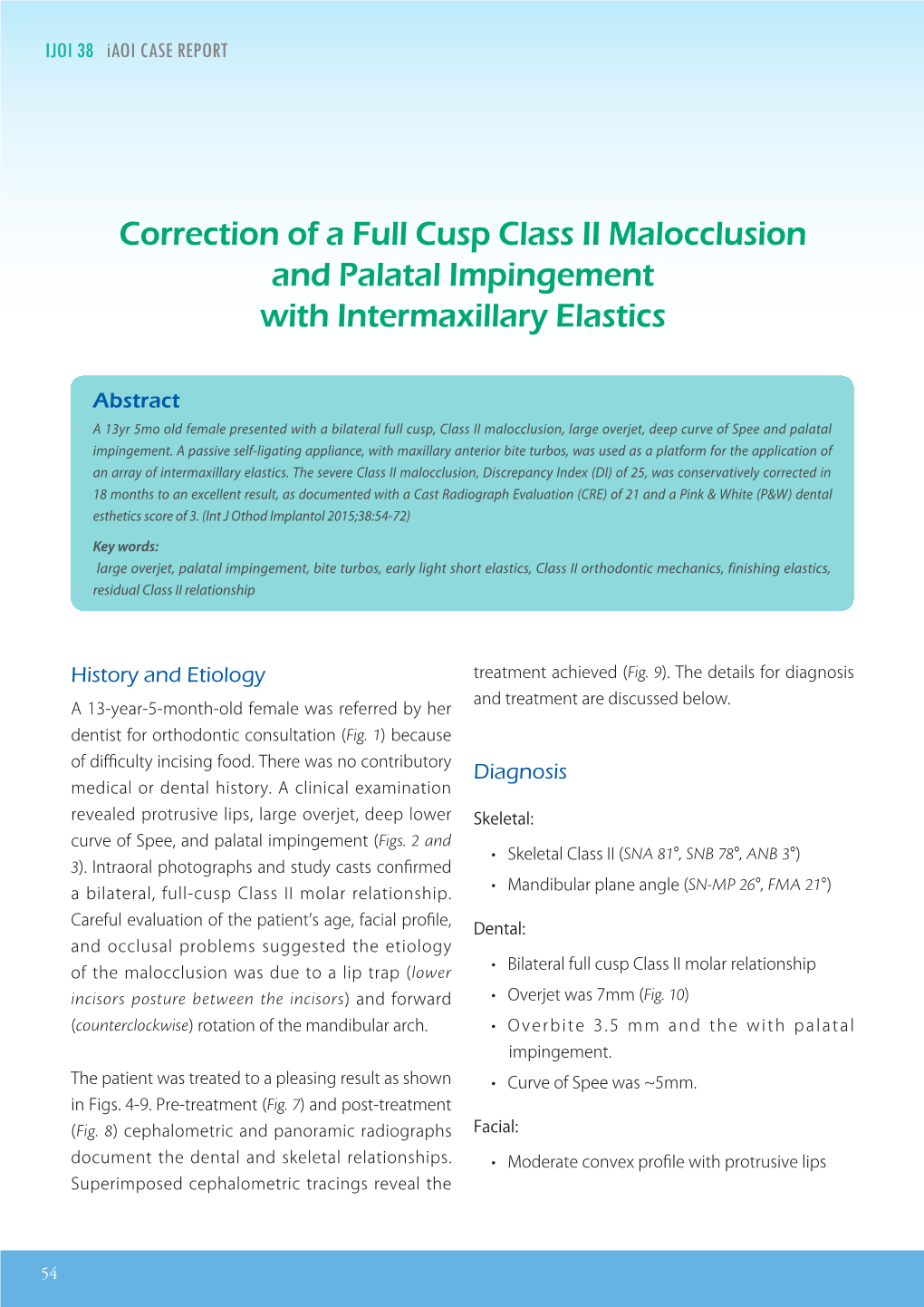 Correction of a Full Cusp Class II Malocclusion and Palatal Impingement with Intermaxillary Elastics IJOI 38