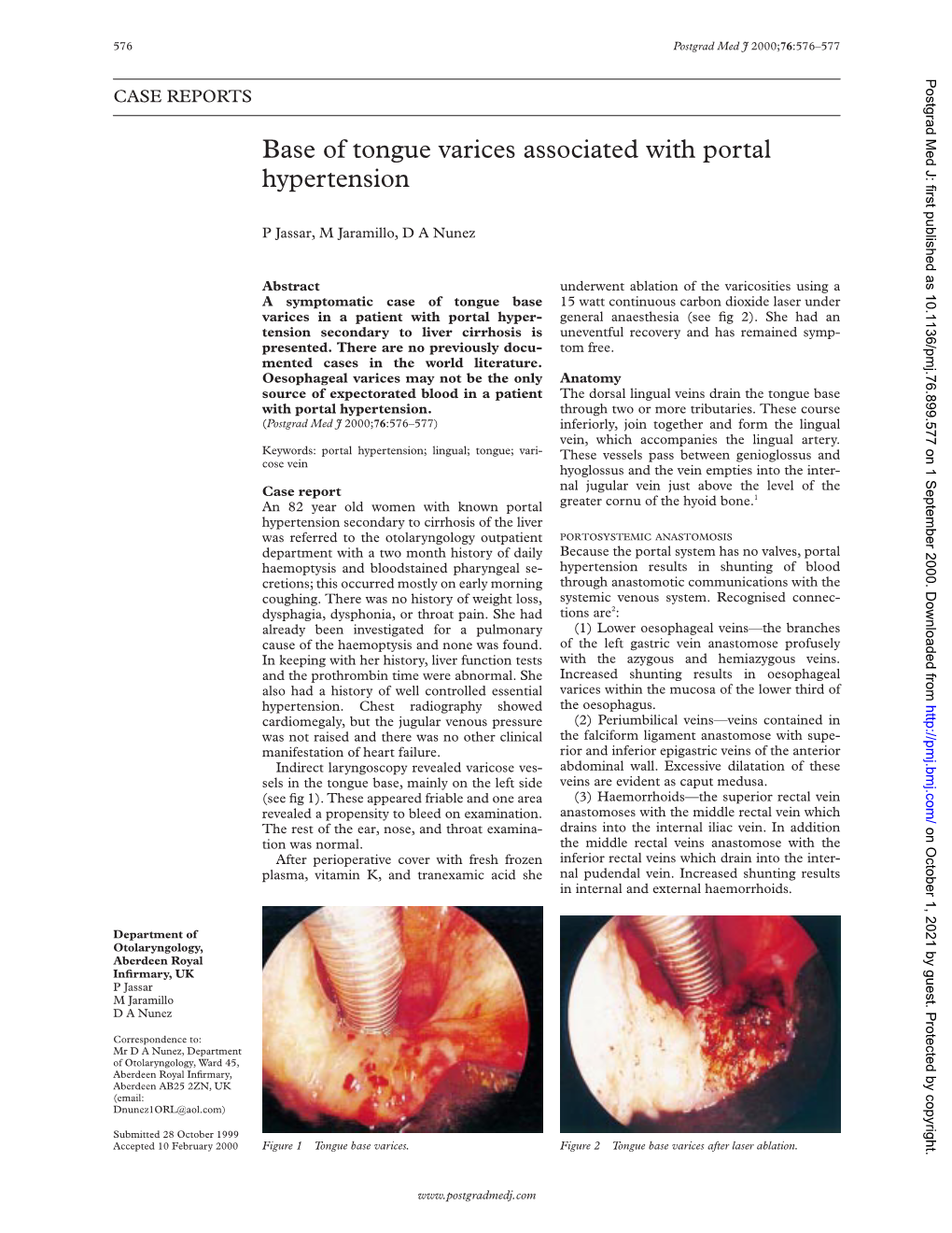 Base of Tongue Varices Associated with Portal Hypertension