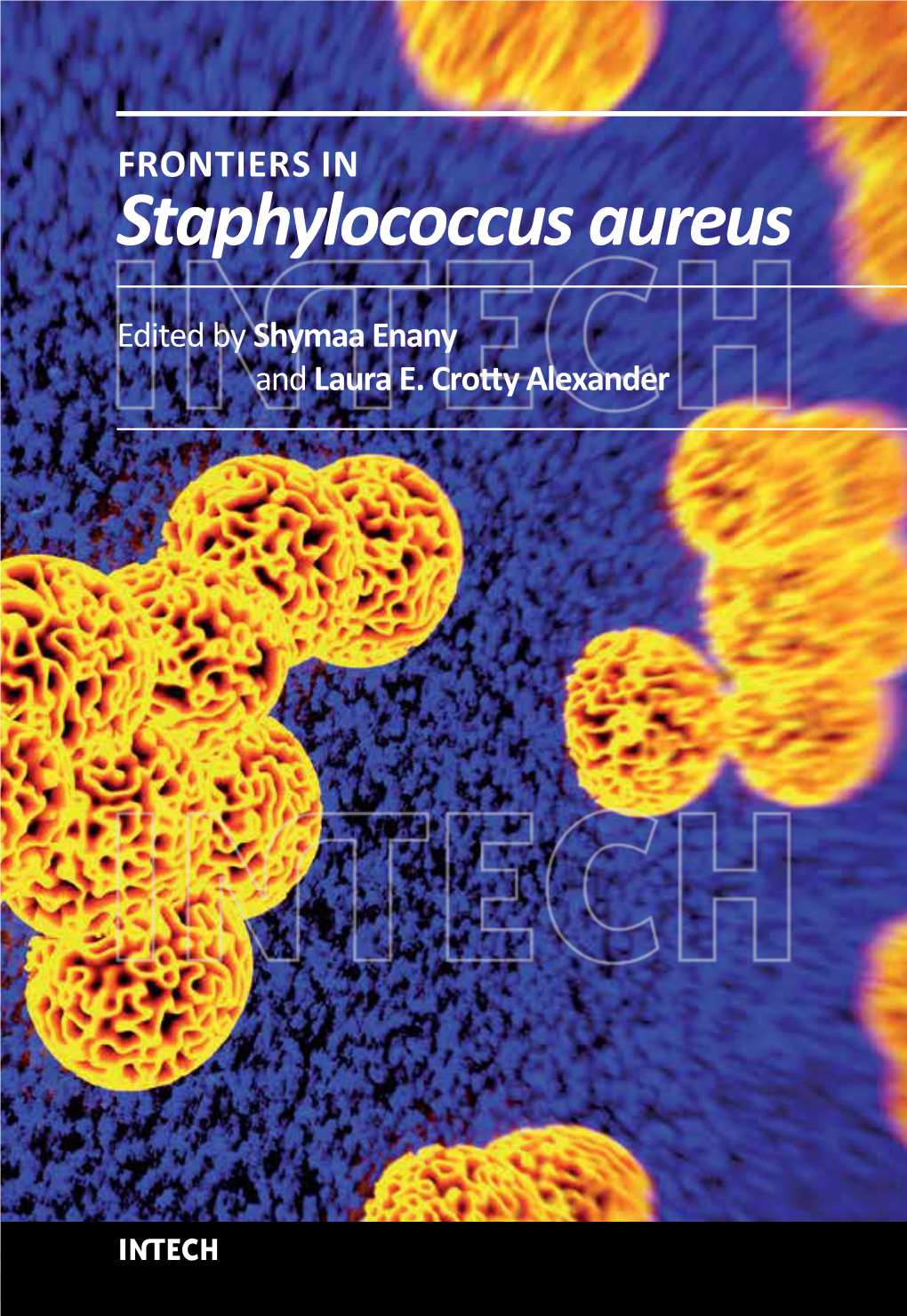 Staphylococcus Aureus Staphylococcus Aureus