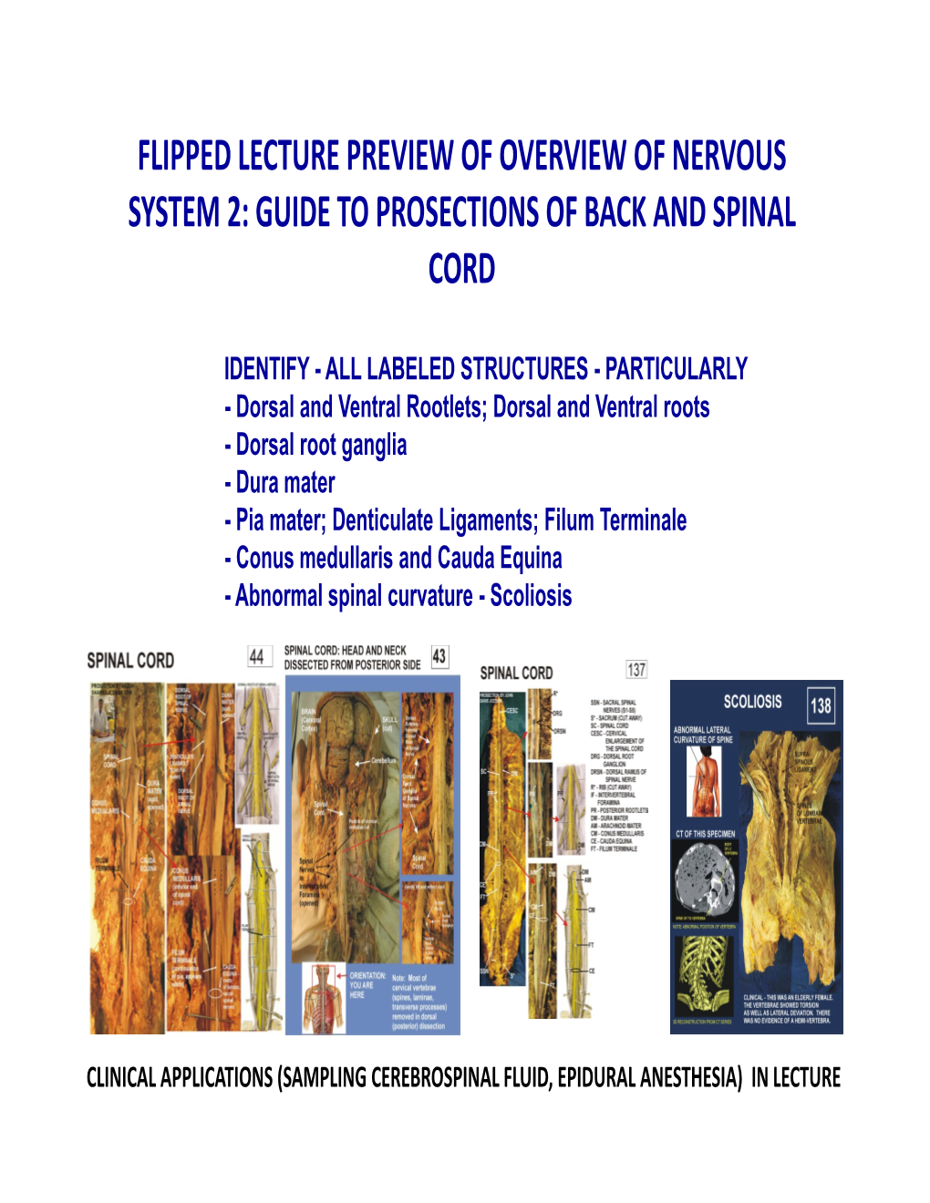 Flipped Lecture Preview of Overview of Nervous System 2: Guide to Prosections of Back and Spinal Cord