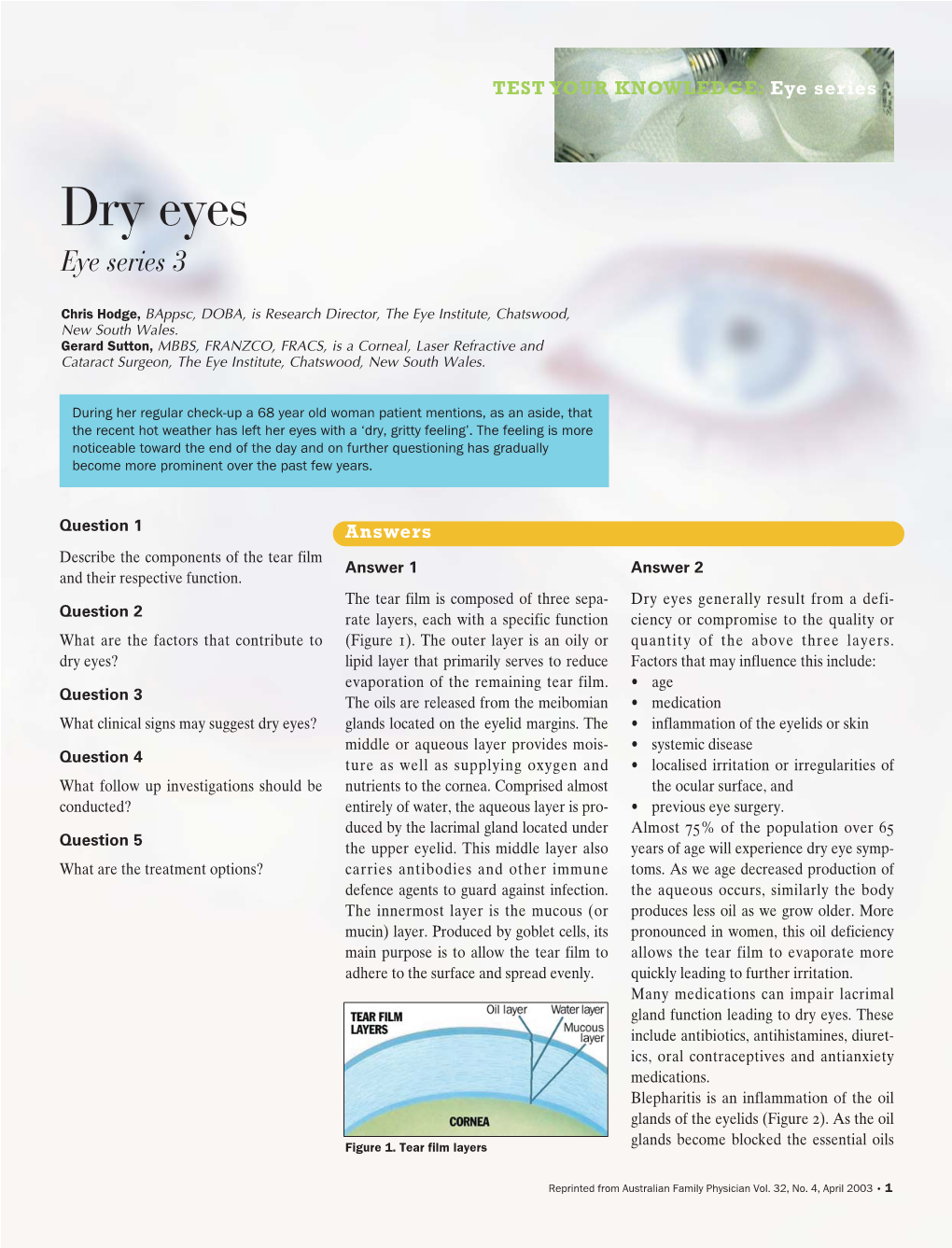 Eye Series Dry Eyes