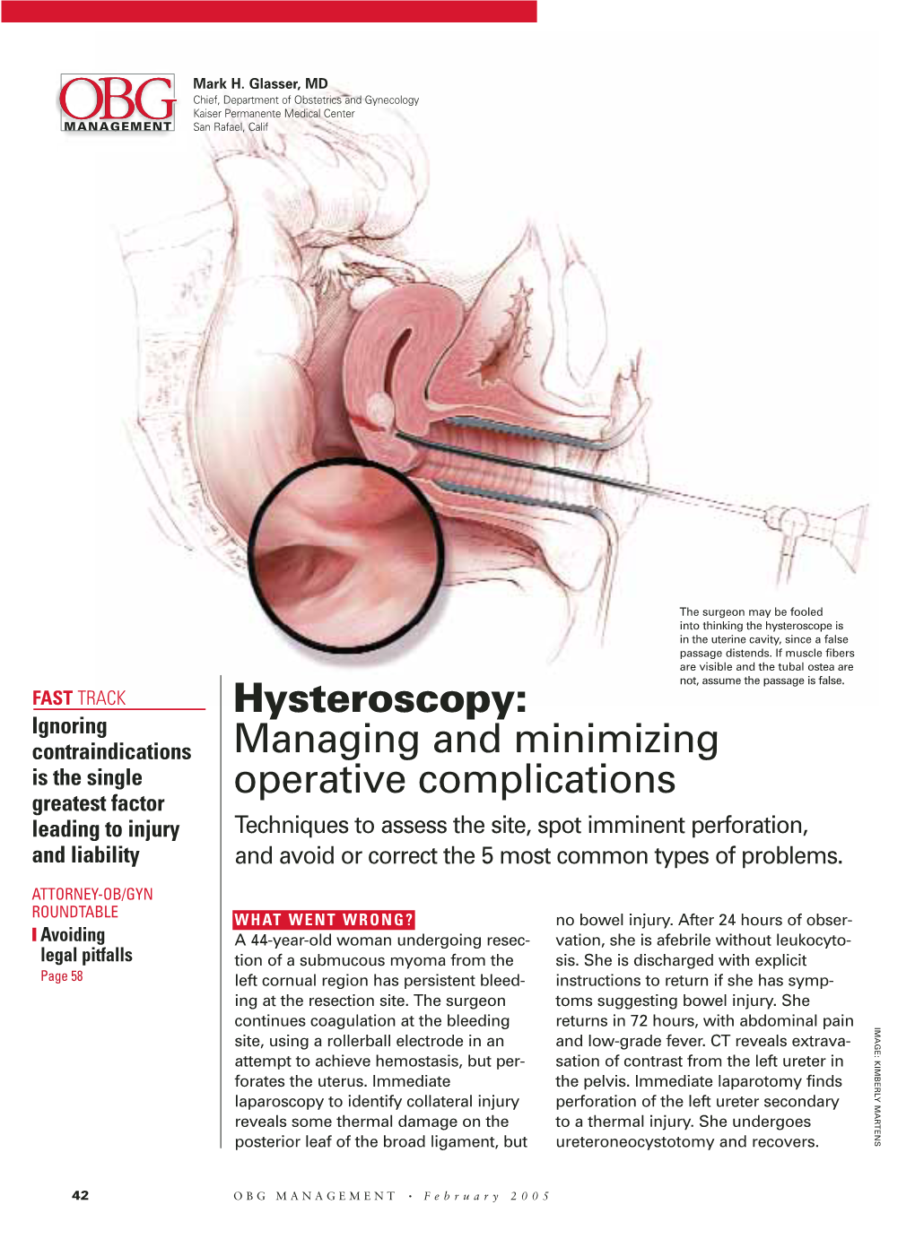 Hysteroscopy: Managing and Minimizing Operative Complications