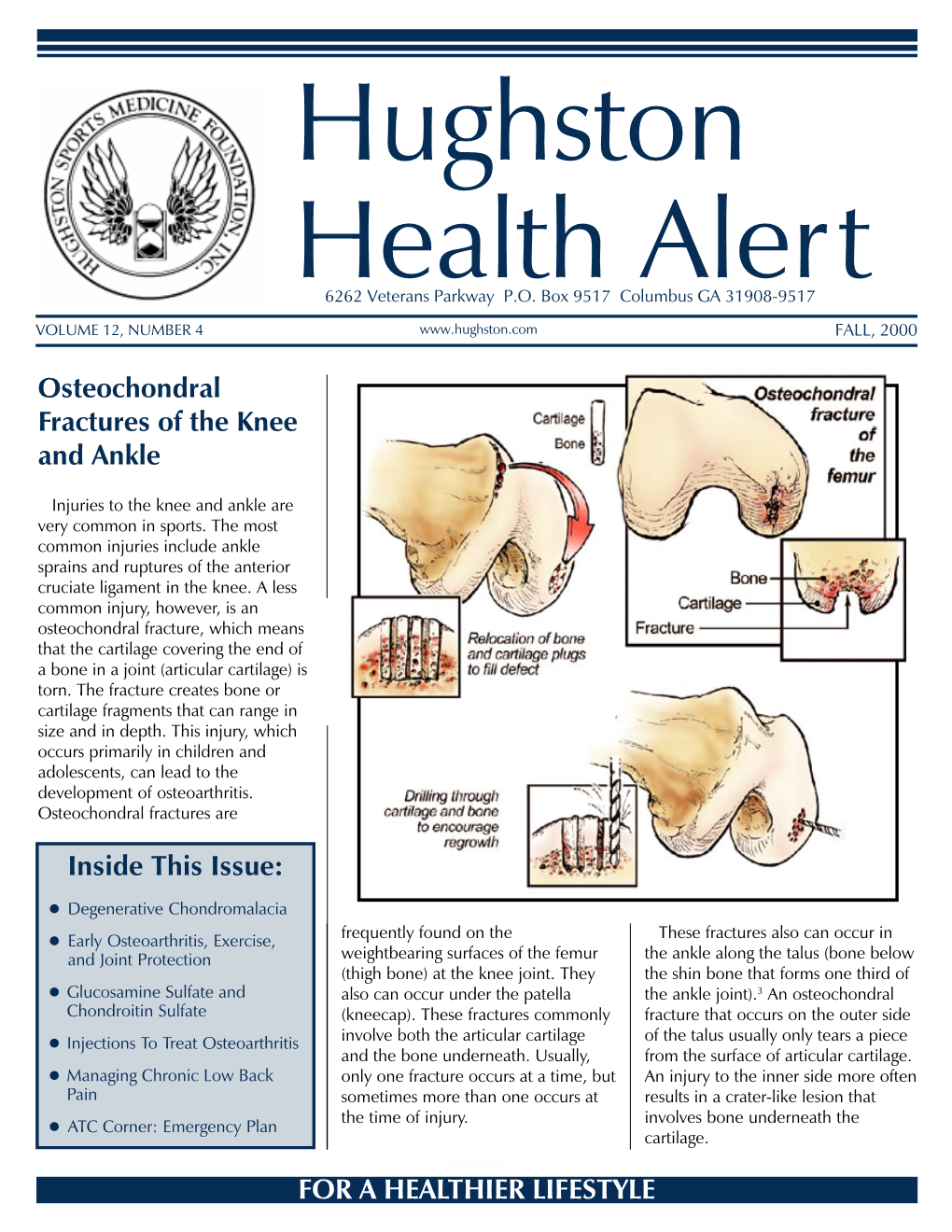 Osteochondral Fractures of the Knee and Ankle