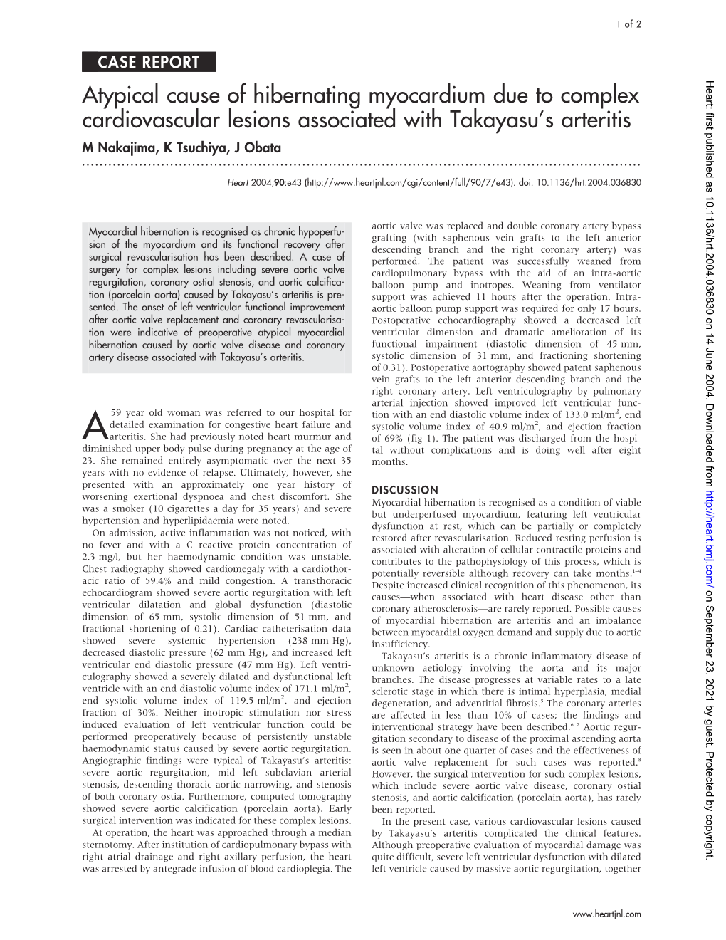 Atypical Cause of Hibernating Myocardium Due to Complex Cardiovascular Lesions Associated with Takayasu’S Arteritis M Nakajima, K Tsuchiya, J Obata